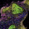 A microscopic image of a biopsied lymph node of a person with untreated HIV, showing large germinal centers containing proliferating B cells (bright green).