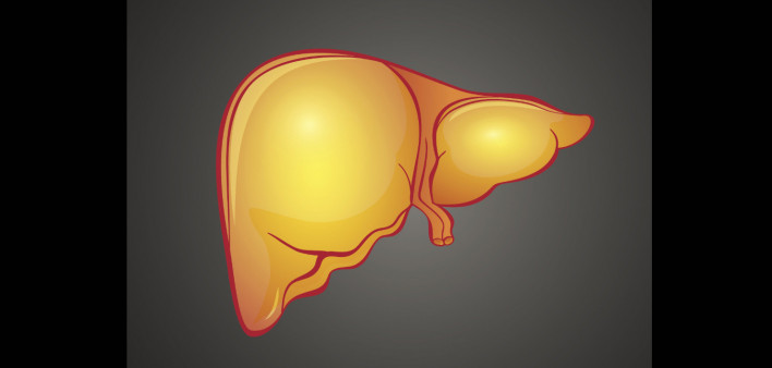 fatty liver