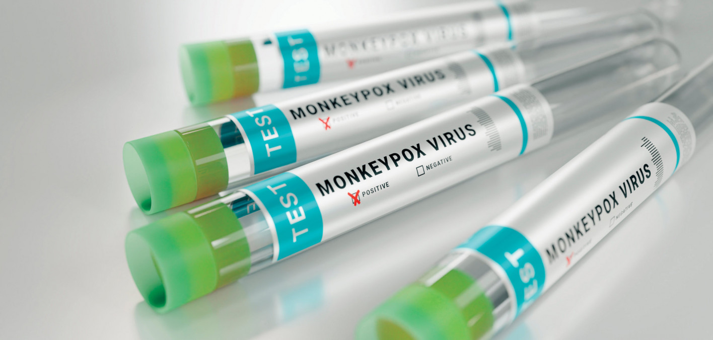 Mpox Can Lead to Persistent Physical and Social Aftereffects - POZ