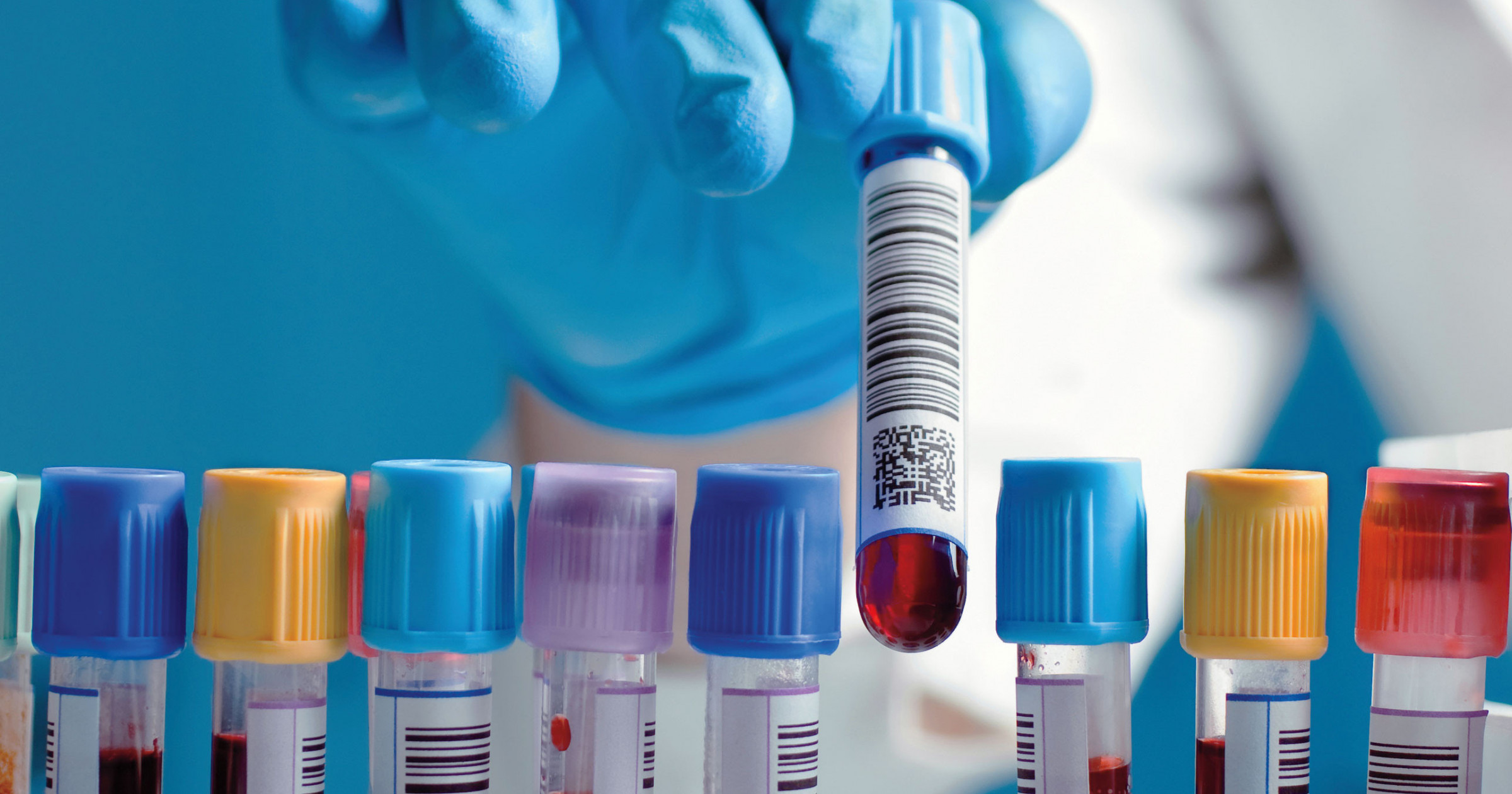 HIV Vaccine Researchers in South Africa Survived U.S. Funding Cuts; Now Comes the Ultimate Challenge