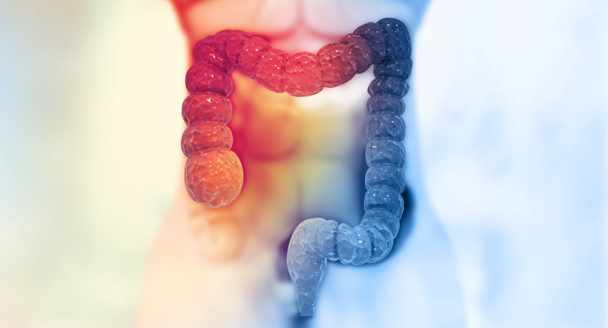 Gut Inflammation & Colorectal Cancer Risk: Epigenetic Memory Explained