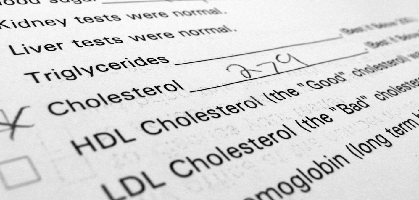 How often should I get my cholesterol checked? Hep