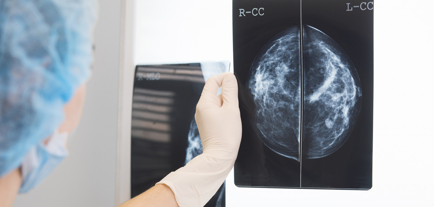 3D Mammography Could Reduce the Need for Breast Biopsies Cancer Health