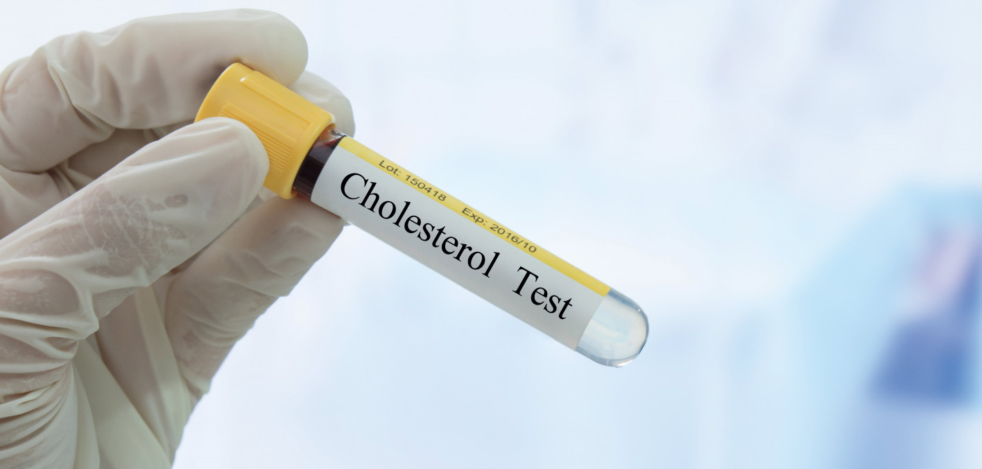 Repatha Safely Lowers LDL Cholesterol in People with HIV POZ